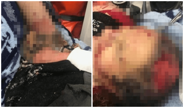 9 köpek saldırıp, elini yüzünü parçaladı!