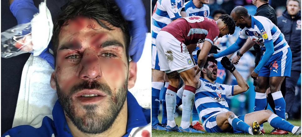 Korkunç sakatlık! Tanınmaz hale geldi...
