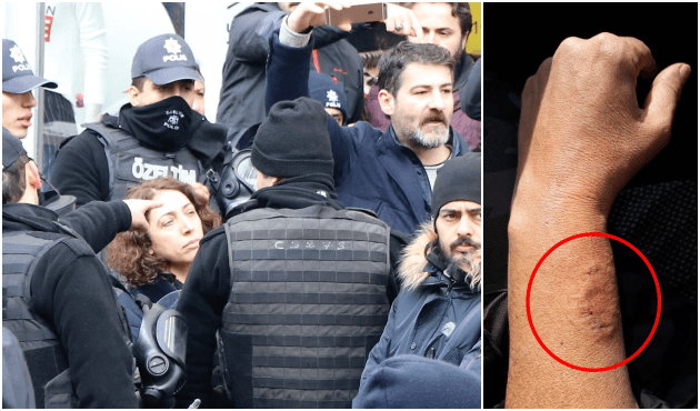HDP'li kadın vekil polisin kolunu ısırdı!