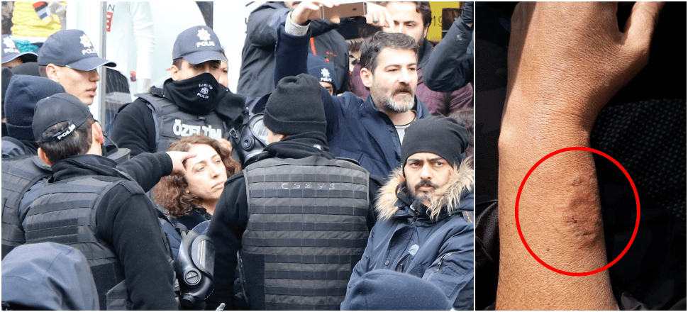 Kadın polisin kolunu ısıran HDP'li vekile şok!