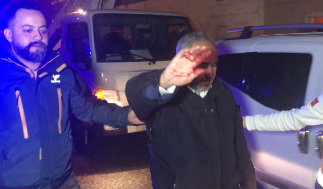 Öfkeli eş kocasını hastanelik etti...