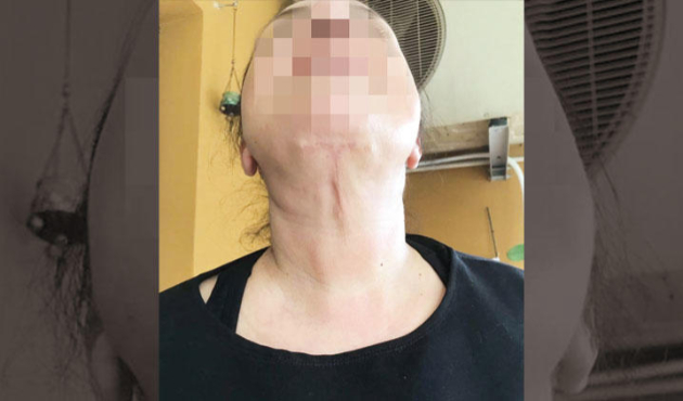 Televizyonda gördüğü doktora gitti bu hale geldi!