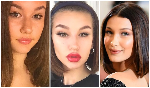 Ameliyat ettiği herkesi Bella Hadid'e benzetiyor!