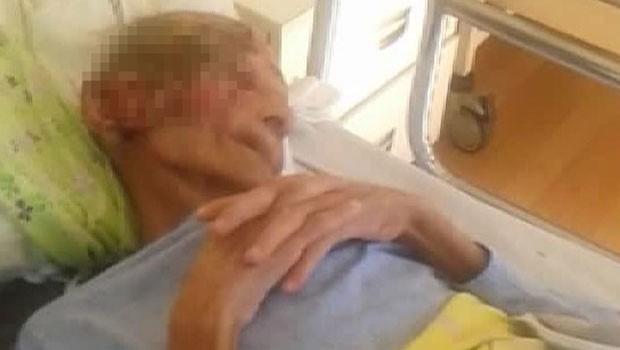 Yüzündeki yaraların nedeni ortaya çıktı