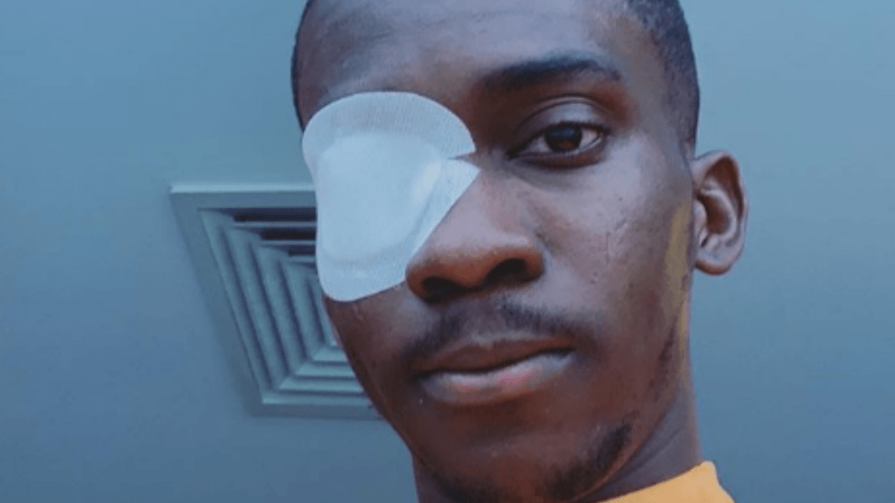 Onyekuru'nun son hali şaşırttı!