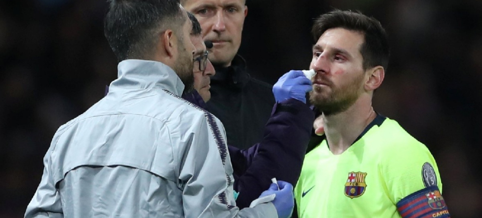 Messi kanlar içinde kaldı!