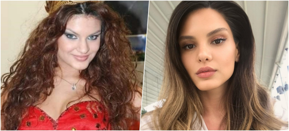 Almeda Abazi'den 'estetik' isyanı!