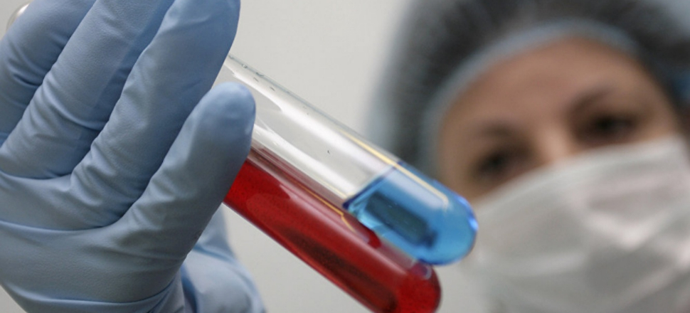 AIDS'in cinsel yolla bulaşması önlendi!