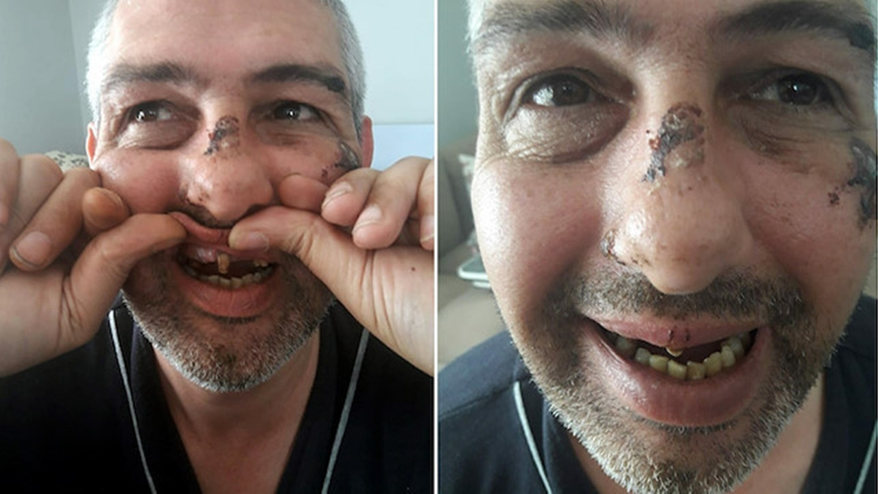Sigara ve bisikletini vermeyince dişlerini döktüler!