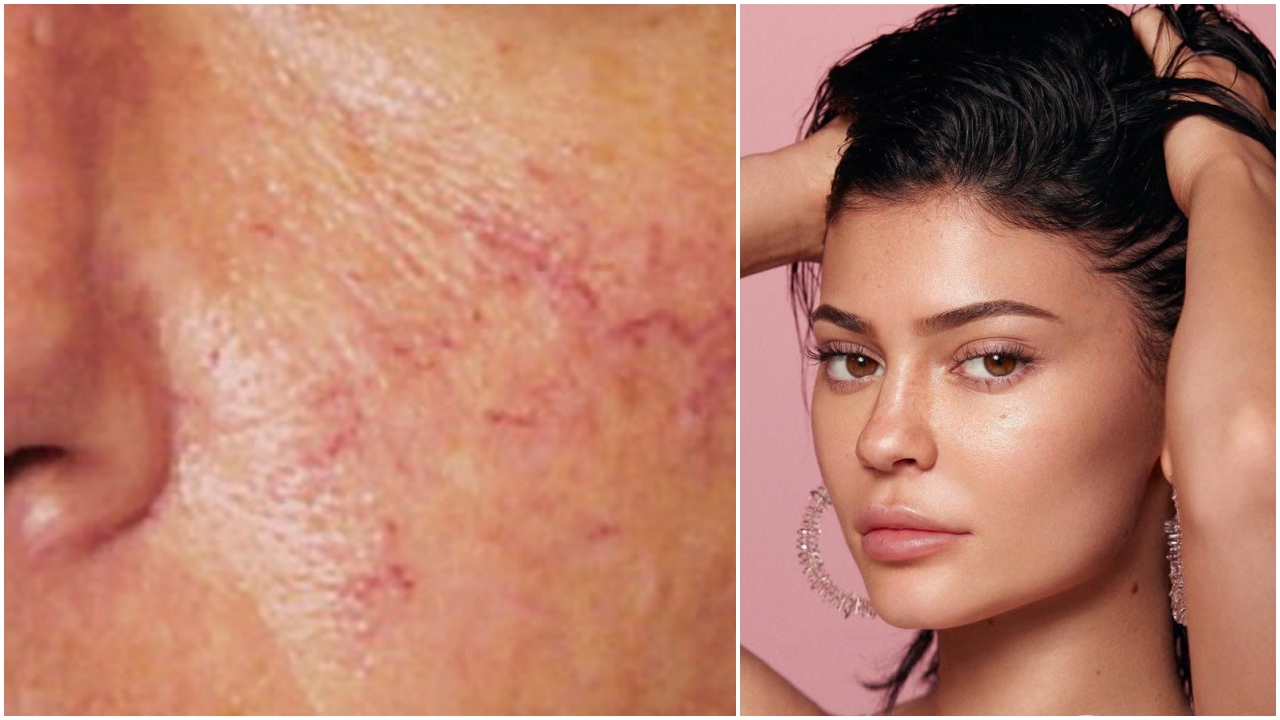 Kylie Jenner'ın yeni ürünleri ciltte kesik yapıyor!