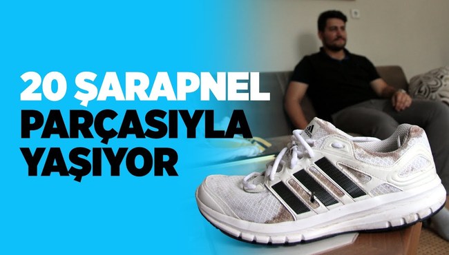 Vücudundaki 20 şarapnel parçasıyla yaşıyor...
