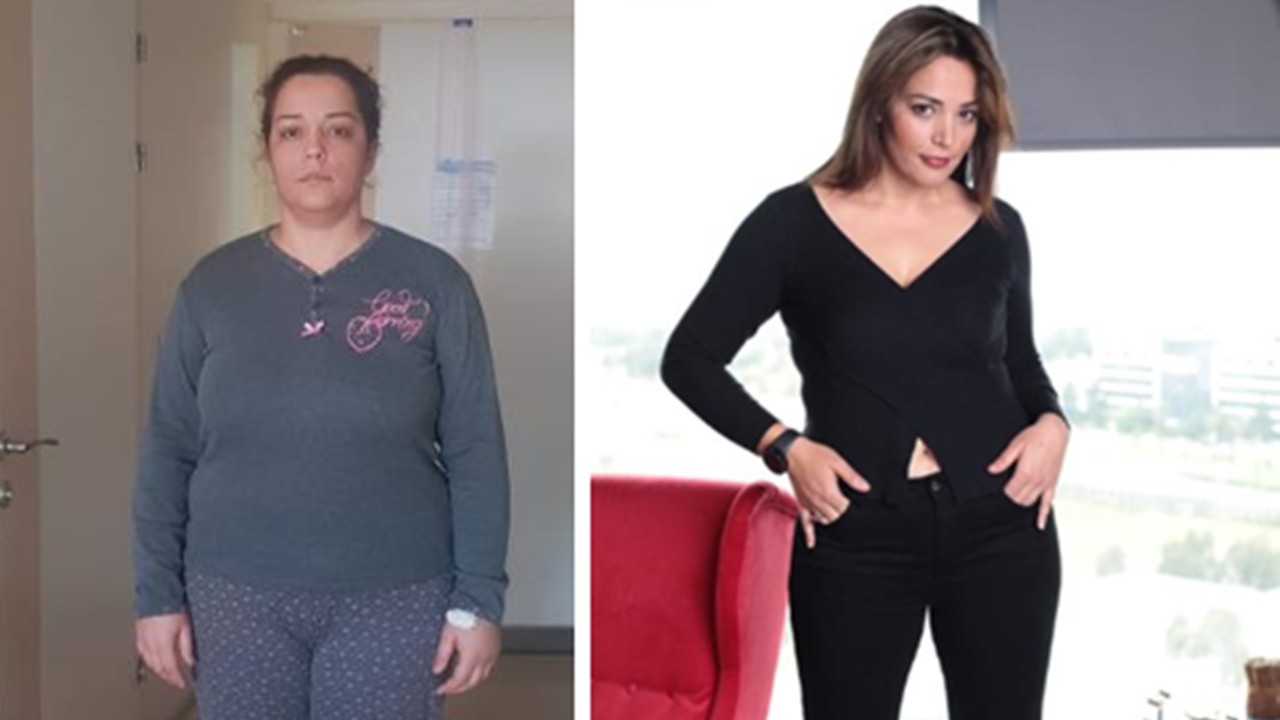 107 kilo olan mankenin son hali görenleri şaşırtıyor!