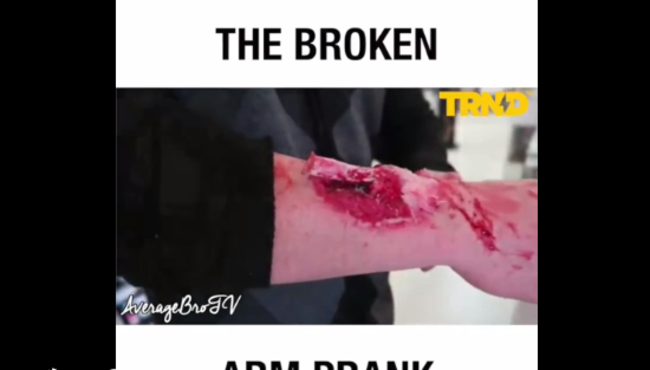 Kırıl kol şakası yaparak insanaların aklını başından alan adam...