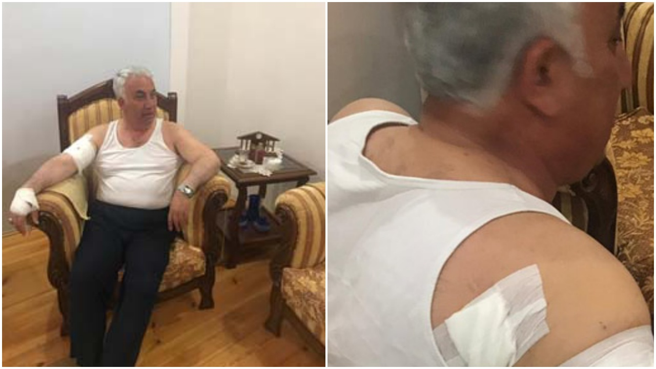 Belediye başkanı köpeklerin hedefi oldu!