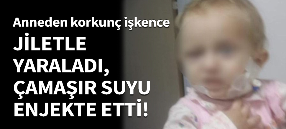 Anneden bebeğine korkunç işkenceler!