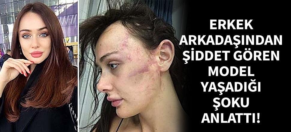 Şiddet gören Sırp model: Vahşice beni dövdü, öldürmek istedi!