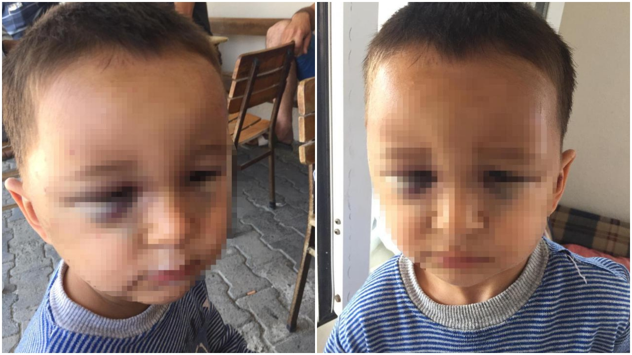 3 yaşındaki çocuk perişan halde bulundu!