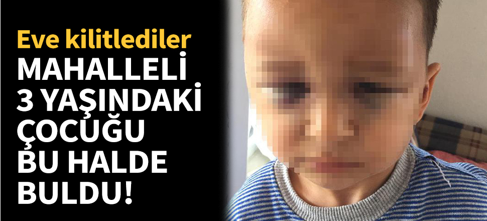 3 yaşındaki çocuk perişan halde bulundu!
