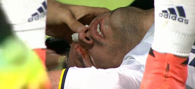 İşte Van Persie'nin sakatlığındaki ambulans krizinin gerçeği!