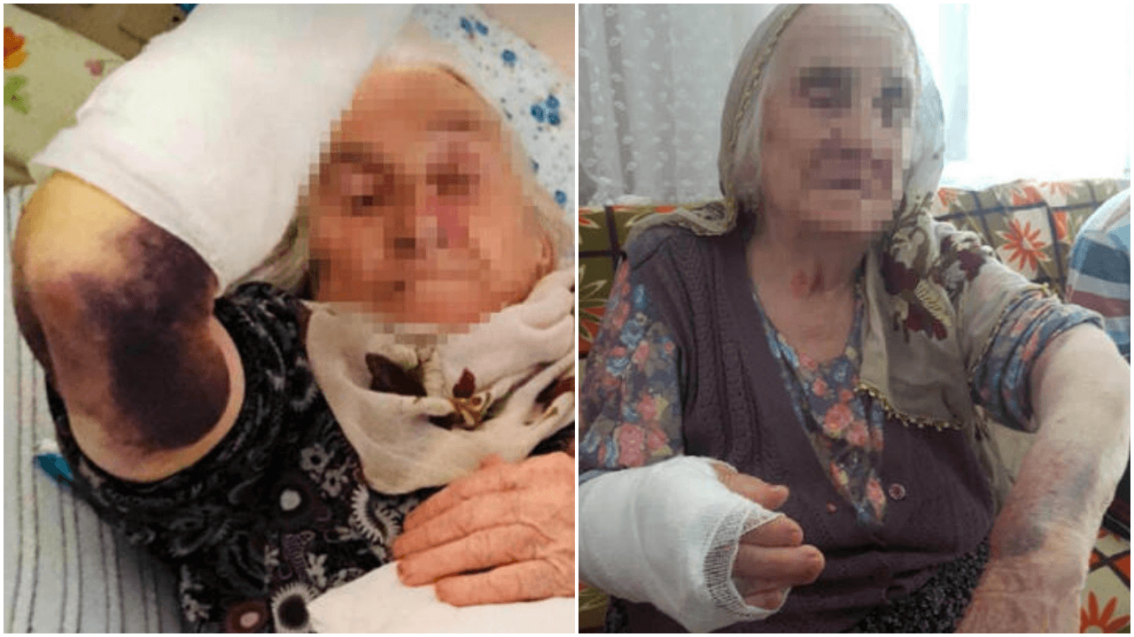 Kaynanasını sopayla döve döve bu hale getirdi!