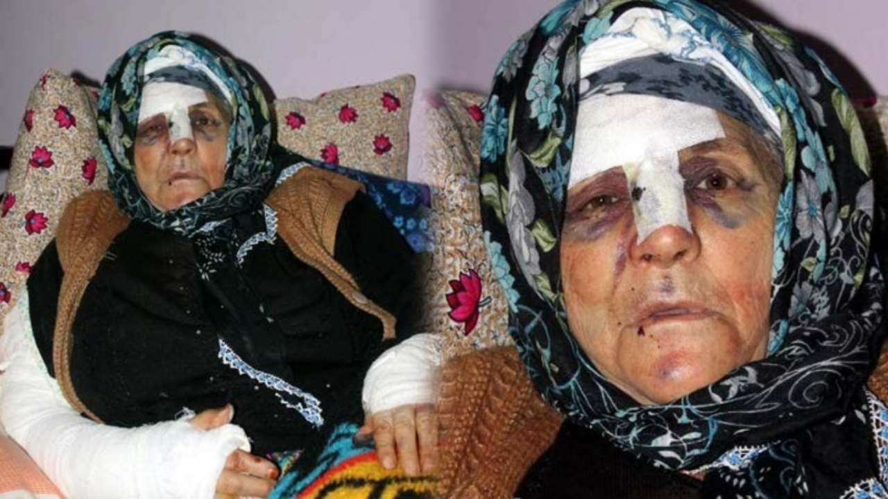Yüzüne maske takıp yaşlı kadına saldırdı!