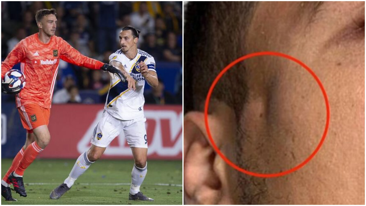 Ibrahimovic rakibini hastanelik etti!
