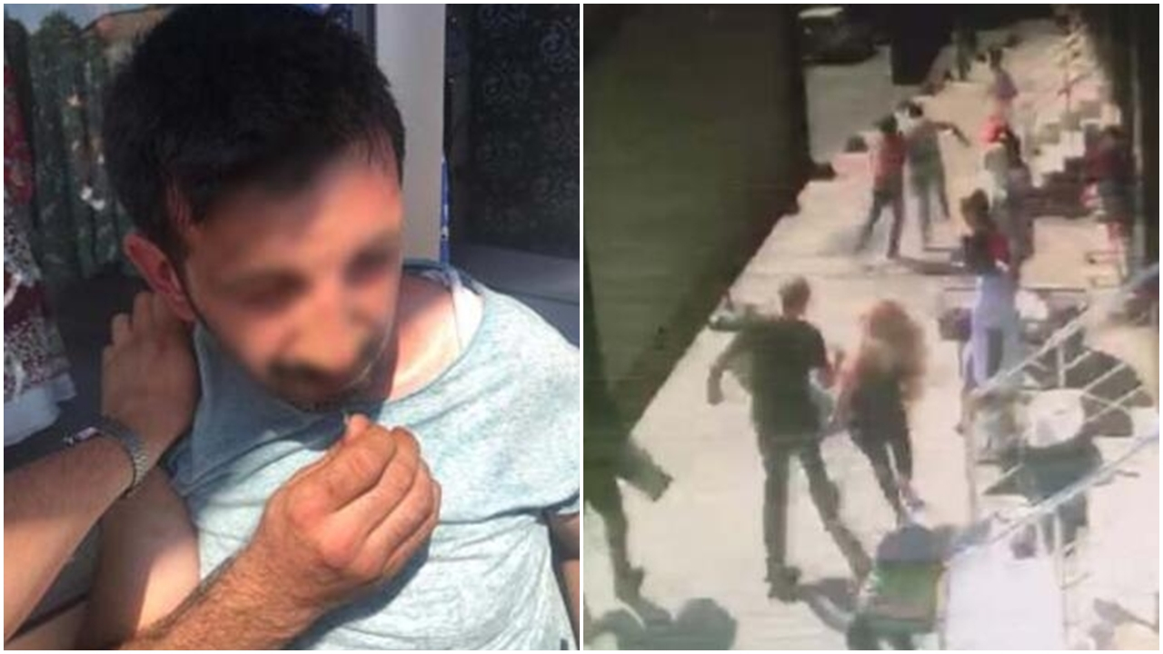 Tacizcisini topuklu ayakkabılarıyla kovaladı!