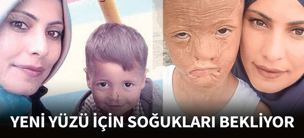 Minik Halil yeni yüzü için gün sayıyor!