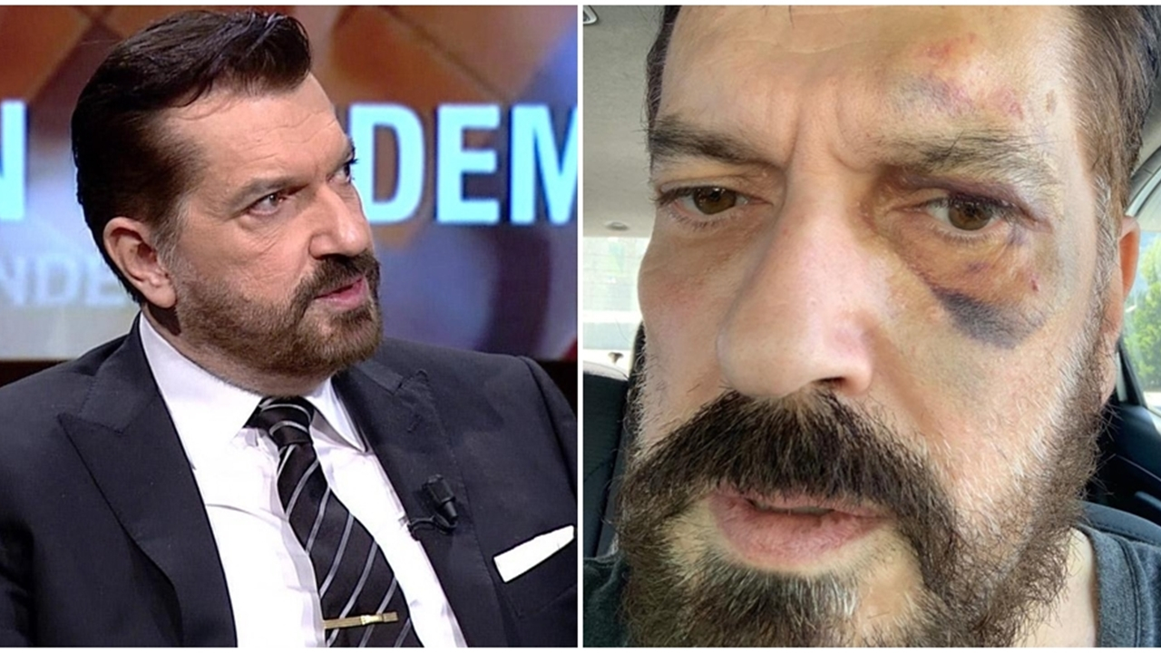 Ünlü anketçi Hakan Bayrakçı'ya saldırı...