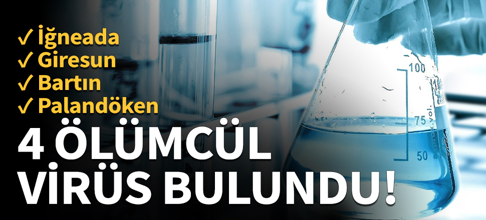 Türk bilim insanları 4 ölümcül virüs buldu!
