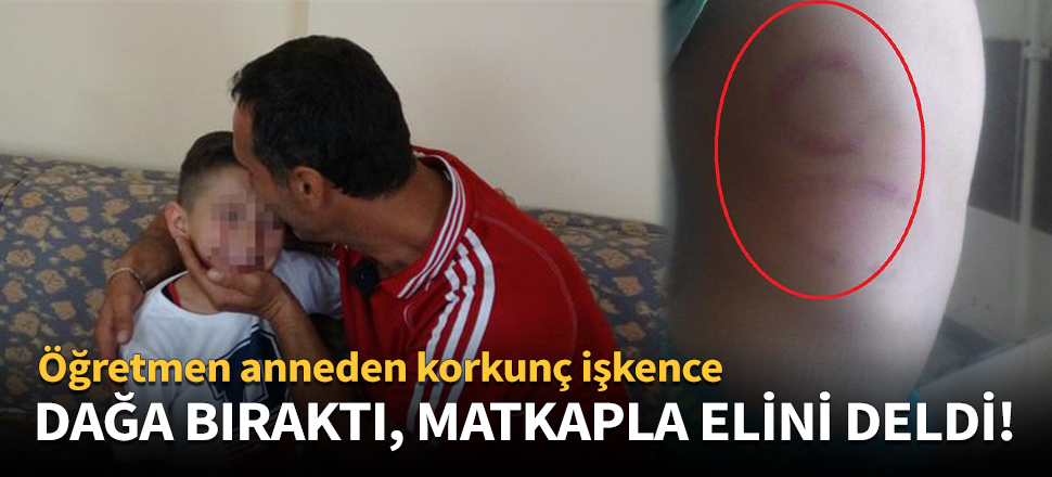 Birlikte yaşadığı adamla gece uyandırıp...