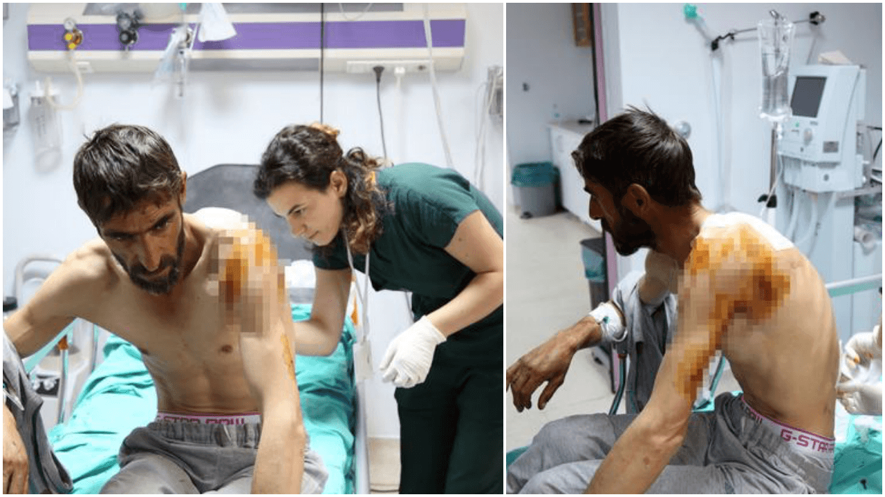 Tunceli'de ayı dehşeti! Odun toplarken sadırdı...