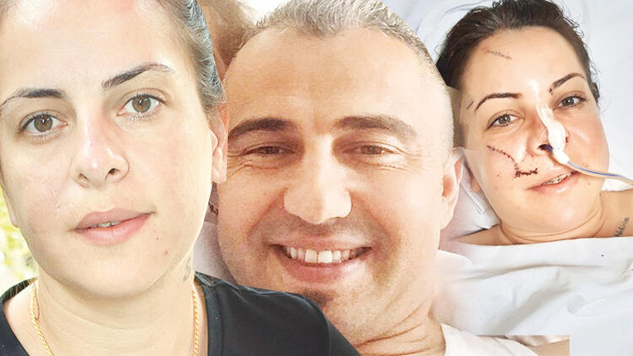 Önce yüzünü kesti sonra 19 yerinden bıçakladı!
