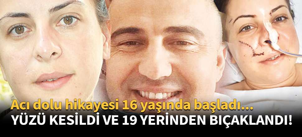 Önce yüzünü kesti sonra 19 yerinden bıçakladı!