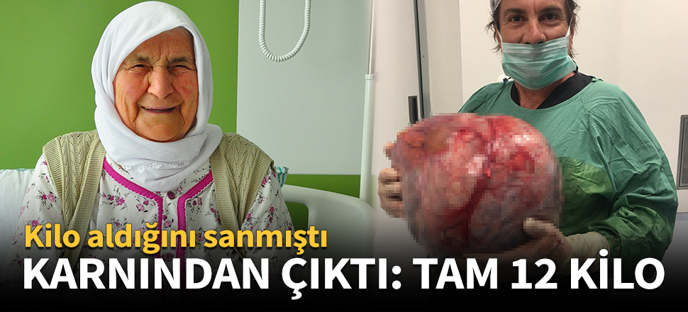 Karnından çıktı: Tam 12 kilo!