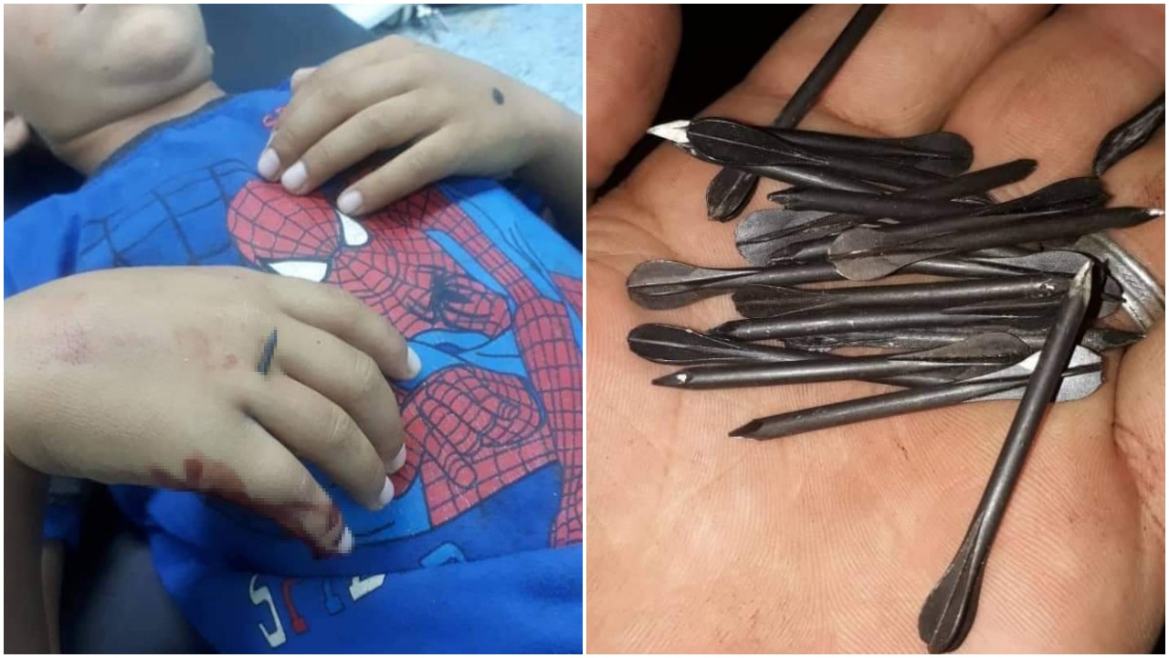 Esed çivili bombayla saldırmaya devam ediyor!