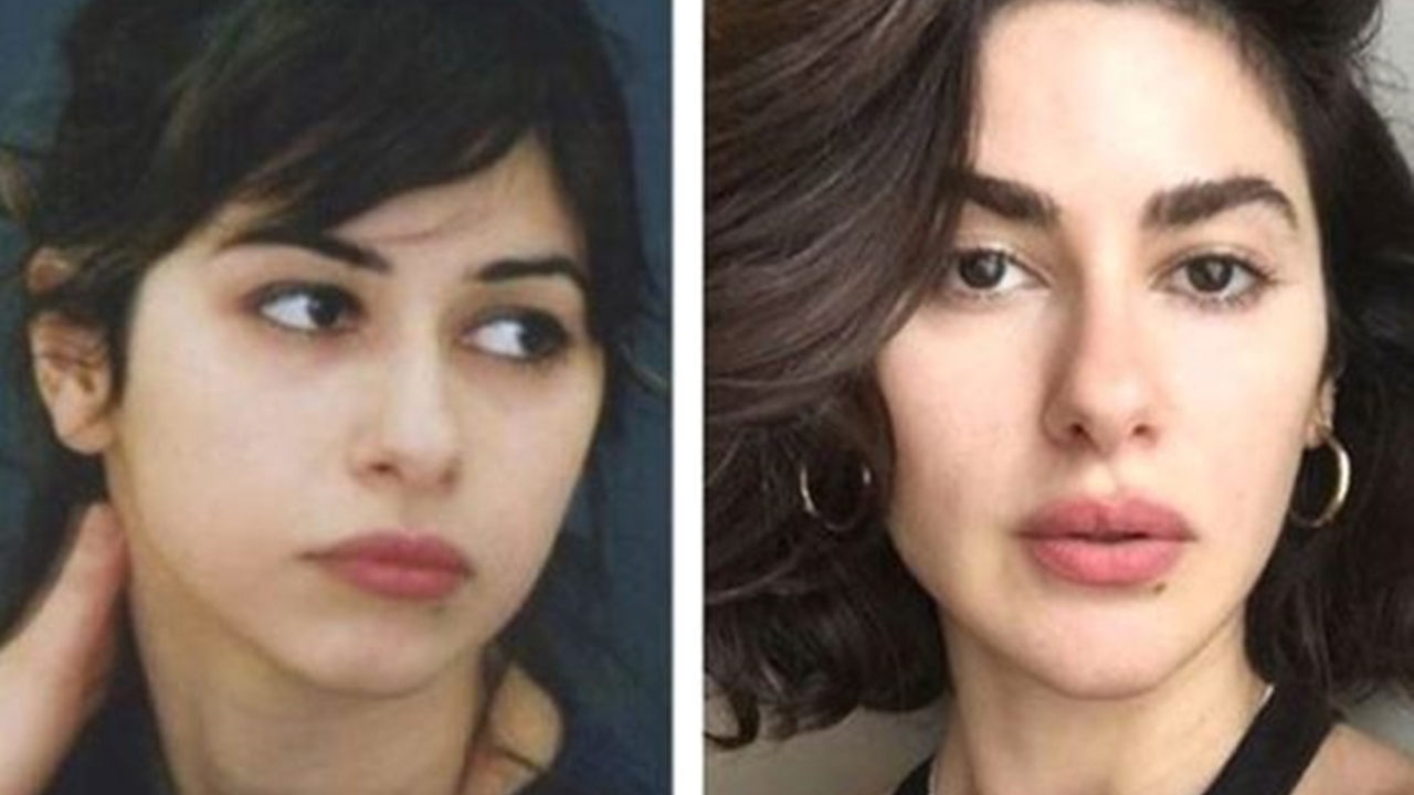 Estetik operasyonlarıyla bambaşka birine dönüştüler!