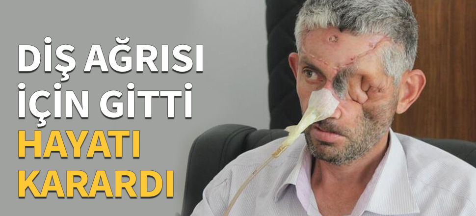 Diş ağrısı için doktora gitti, hayatı karardı!