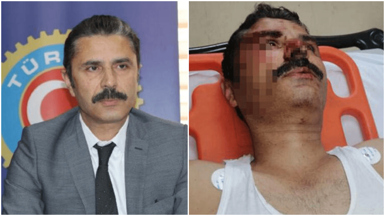 Kocaeli'nde sendikacıya muştalı saldırı!
