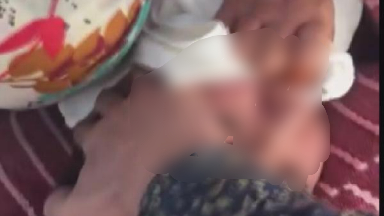 Otizmli çocukların aileleri isyan etti!