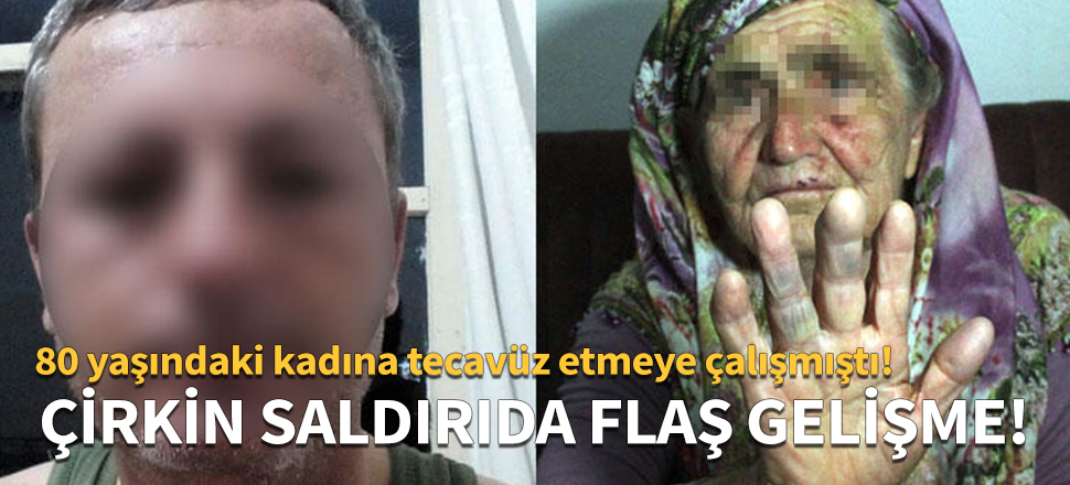 80 yaşındaki kadına çirkin saldırıda flaş gelişme!