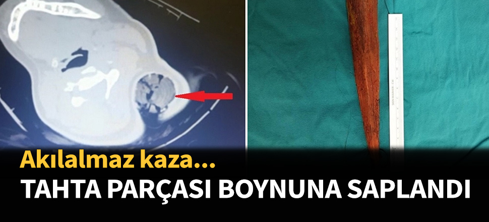 Tahta parçası boynuna saplandı...