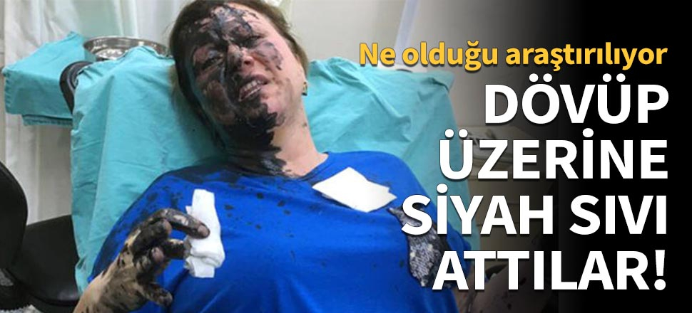 Dövüp üzerine siyah sıvı attılar!