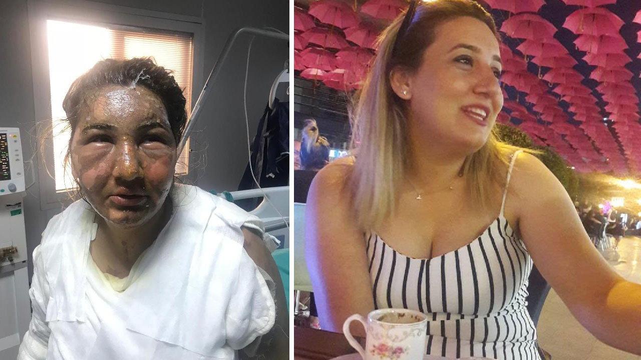 Cezaevinden izinli çıktı, eski eşini kızgın yağ ile yaktı!
