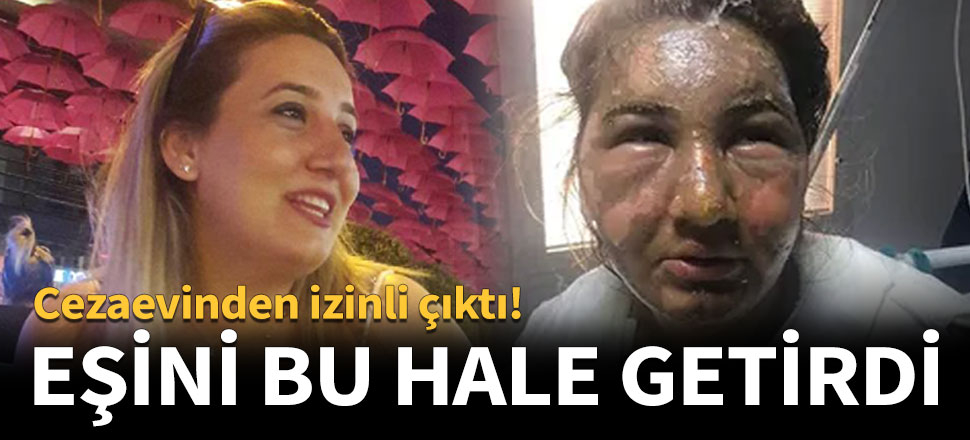 Cezaevinden izinli çıktı, eski eşini kızgın yağ ile yaktı!