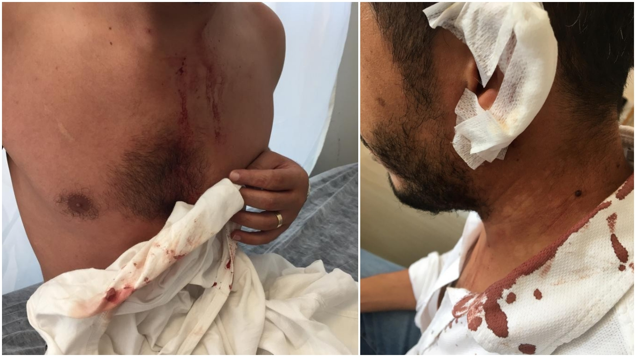Diyarbakır'da öğretmen bıçaklandı!