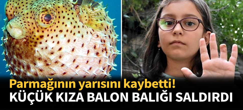 8 yaşındaki çocuğa balon balığı saldırdı!