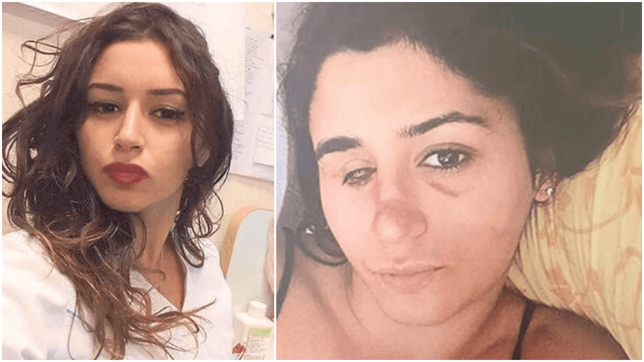 Genç kadın eşi tarafından tanınmaz hale getirildi!