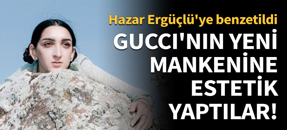 Güzellik algısını değiştiren mankene estetik yaptılar!