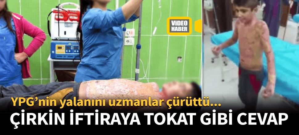 YPG'nin 'kimyasal' yalanını uzmanlar çürüttü!